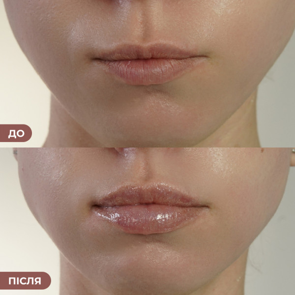 Набор против трещин и для увлажнения губ Hillary Lip Repair Hydration Set