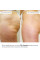 Антицеллюлитные энзимные обертывания Hillary Anti-cellulite Bandage Zymo Cell