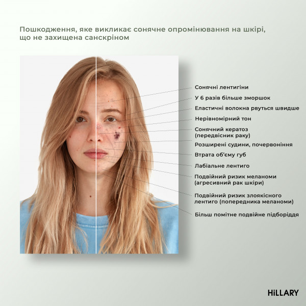 Солнцезащитная сыворотка SPF 30 с витамином С+ Базовый набор для ухода за кожей лица жирного типа