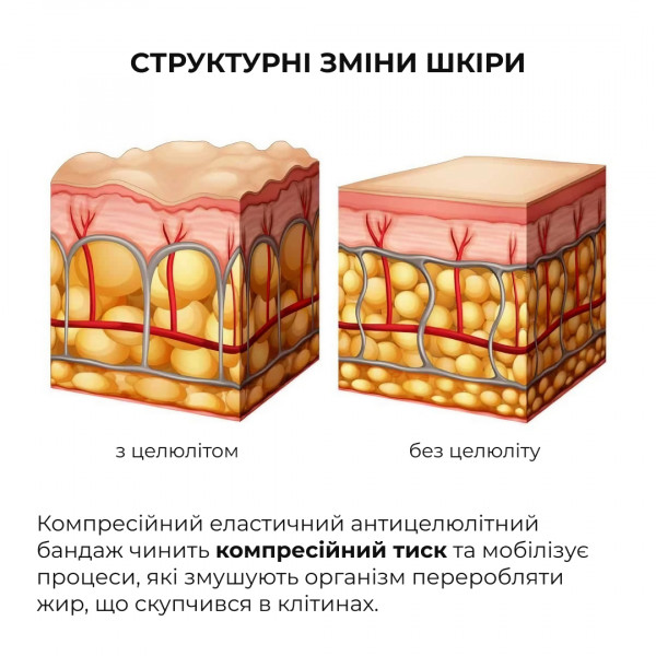 Антицеллюлитные обертывания с маслом ксимении Hillary Anti-cellulite Bandage African Ximenia