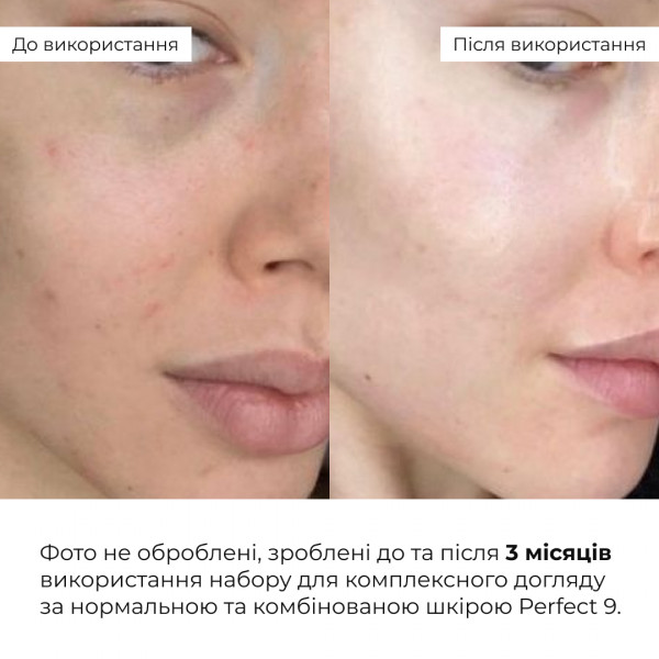 Набор для комплексного ухода за нормальной и комбинированной кожей Hillary Perfect 9