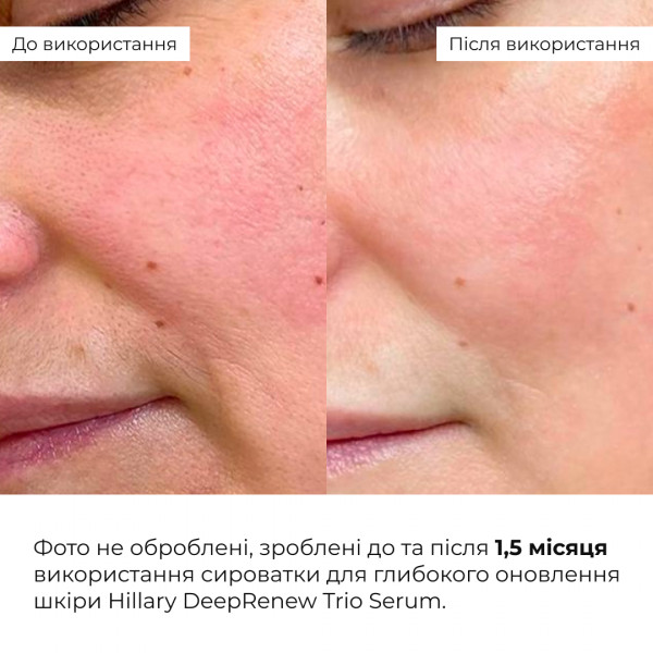 Сыворотка для глубокого обновления кожи Hillary DeepRenew Trio Serum, 30 мл