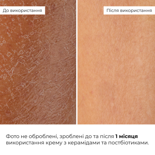 Комплекс антивікового догляду для контролю жирності та зменшення ознак втоми HiLLARY