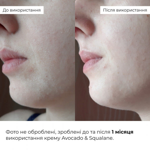 Весенний уход для сухого типа кожи