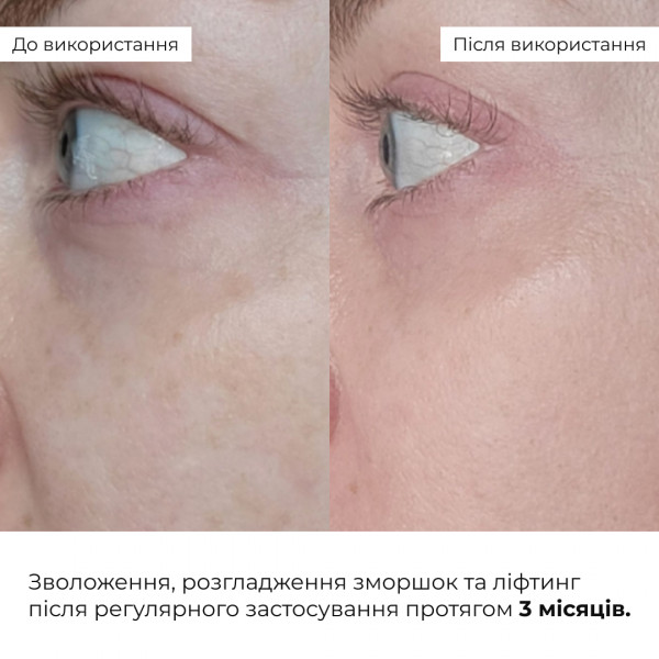Антивозрастной базовый уход для лица Hillary Basic Anti-Aging Care