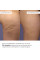 Набор охлаждающих обертываний Hillary Cooling Anti-Cellulite Wrap Set