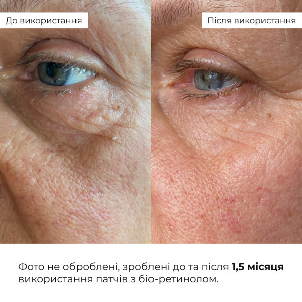 Освежающие и разглаживающие патчи под глаза Hillary Bacuchiol Wrinkle Correcting Vitamin C Refreshing