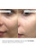 Освежающие и разглаживающие патчи под глаза Hillary Bacuchiol Wrinkle Correcting Vitamin C Refreshing