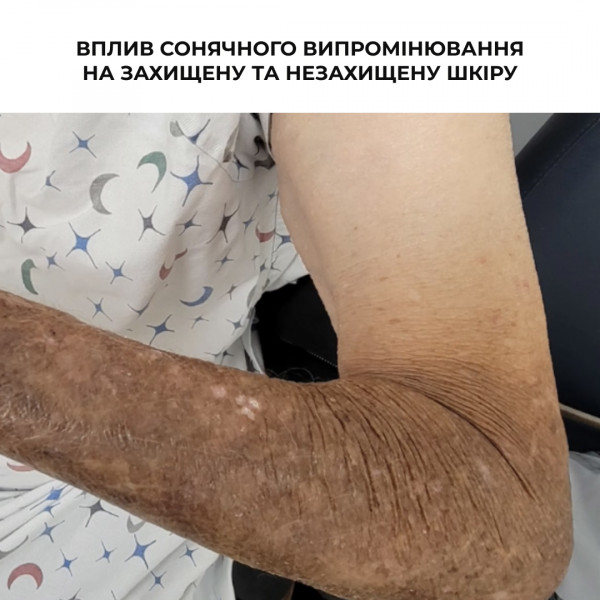 Набор из четырёх средств для ухода за кожей тела Hillary Body Care Set