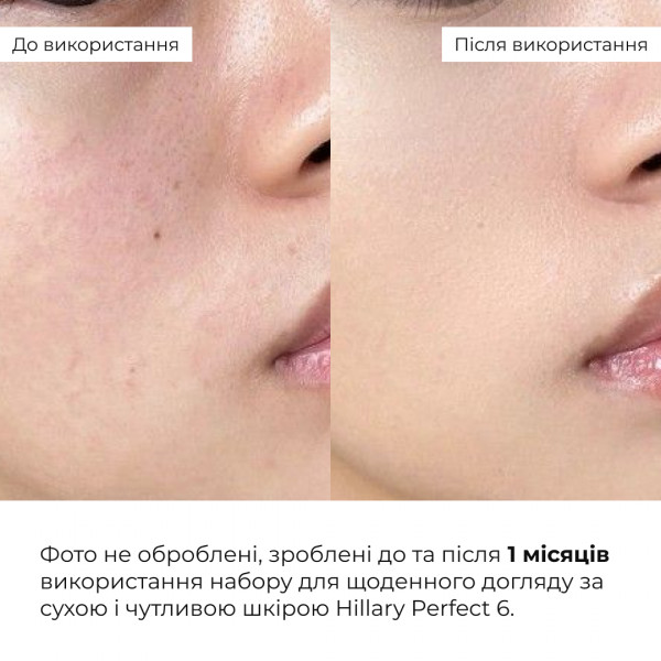 Набор для ежедневного ухода за сухой и чувствительной кожей Hillary Perfect 6