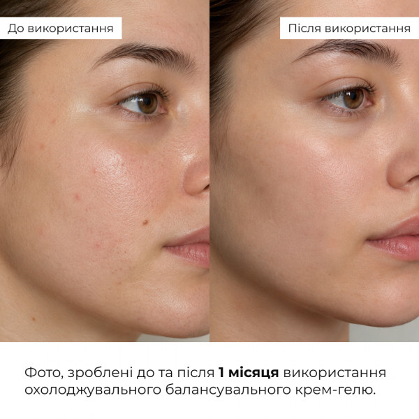 Комплекс щоденного догляду для жирної та комбінованої шкіри Hillary Daily Care Complex for Oily & Combination Skin