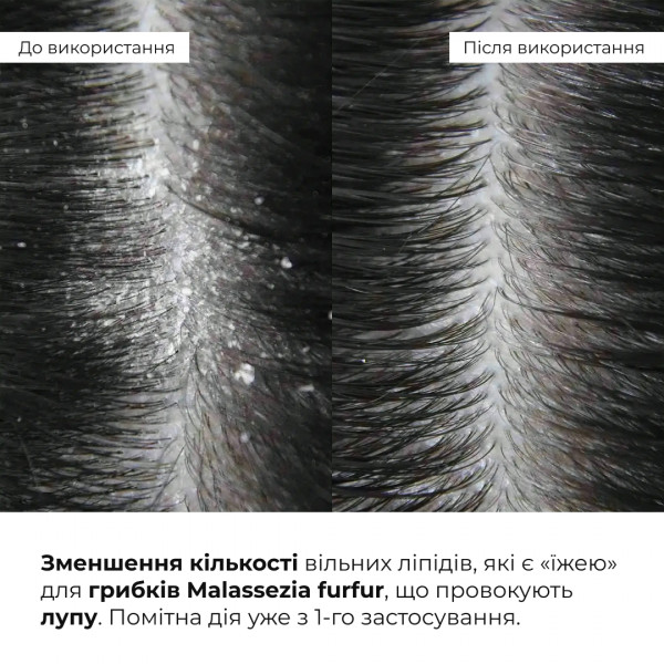 Комплекс для всіх типів волосся Hillary Perfect Care Hair Nori