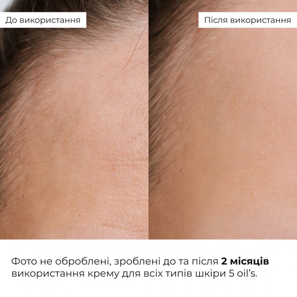 Весенний уход для нормального типа кожи