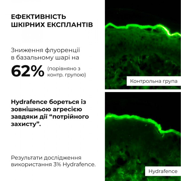 Весенний уход для нормального типа кожи