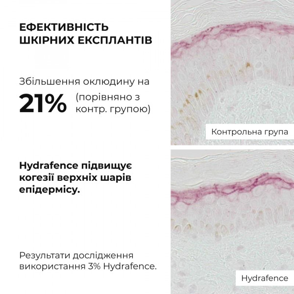 Весенний уход для нормального типа кожи