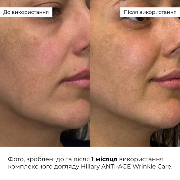 Комплексный уход Hillary ANTI-AGE Wrinkle Сare
