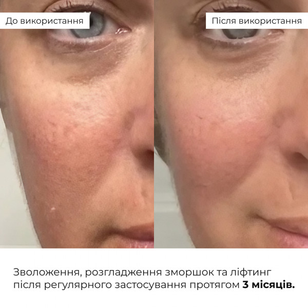 Антивековой ежедневный уход за лицом Hillary Daily Anti-Aging Care