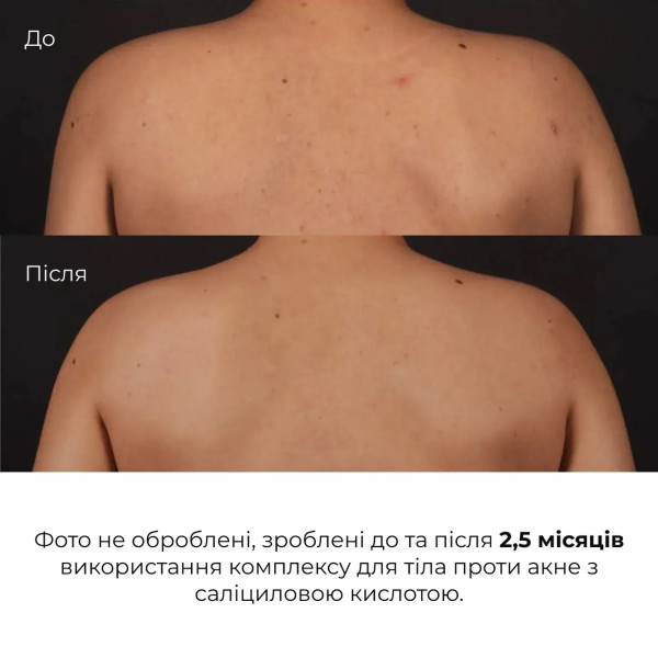 Набор для тела Hillary Body Care