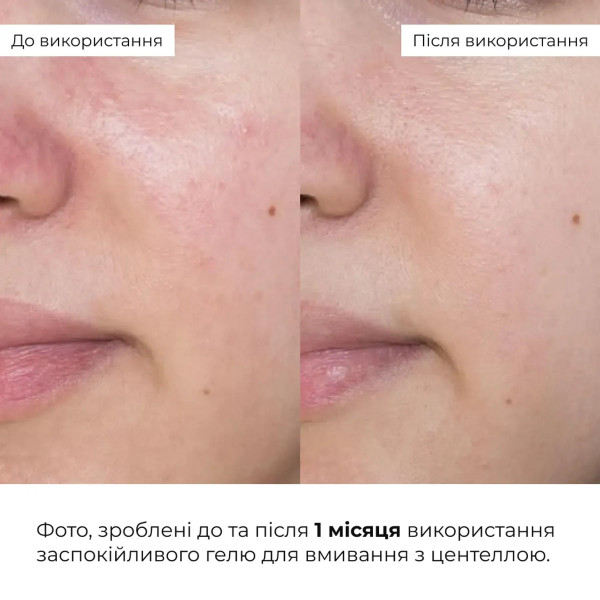 Набор с центеллой: гель, тонер-пэды и сыворотка Hillary Centella Face Care Set