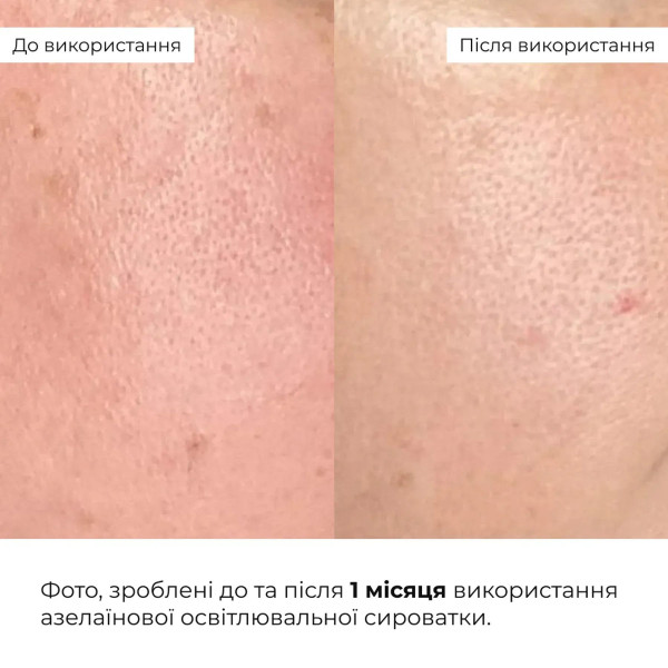 Набор косметических средств для ухода за кожей лица Hillary Face Care Set