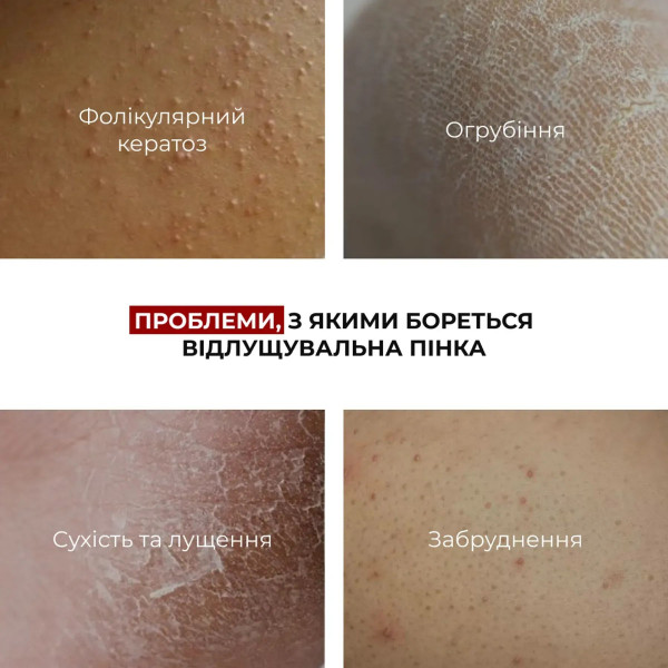 Набор для быстрого и равномерного загара без пятен Hillary Fast Even Tan Complex