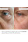 Комплект для лифтинга кожи лица и увлажнение губ Hillary Face Lifting Lip Hydration Set