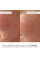 Комплект для лифтинга кожи лица и увлажнение губ Hillary Face Lifting Lip Hydration Set