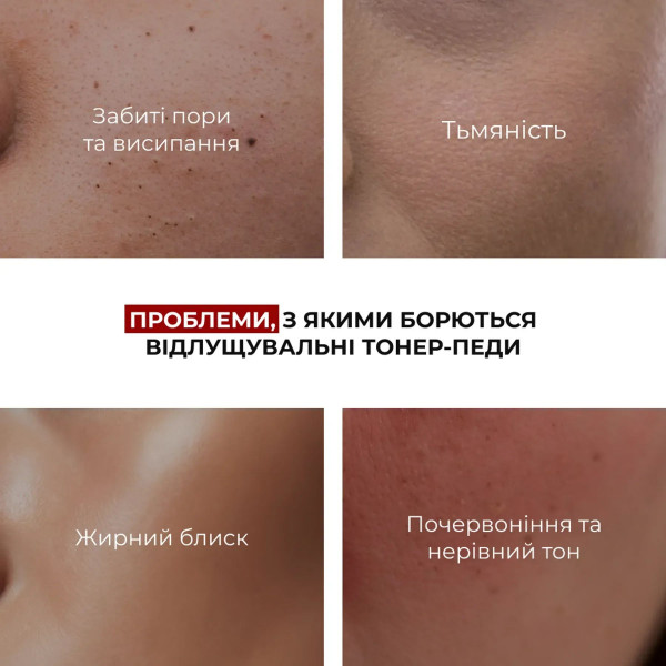 Комплекс для двухуровневого обновления и успокоения кожи Hillary Dual-Level Renewal Soothing Complex