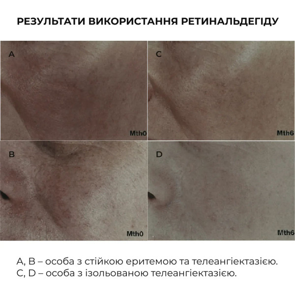 Комплекс для ночного обновления и дневной защиты кожи Hillary Night Renewal Day Protection Skin Complex