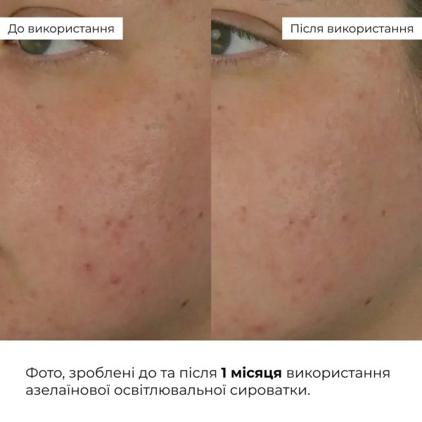 Набор Hillary с сывороткой Azeclair 30 мл и кремом с керамидами 50 мл