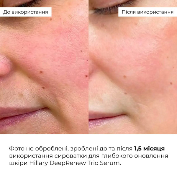 Набор для ежедневного ухода за кожей тела Hillary Body Care