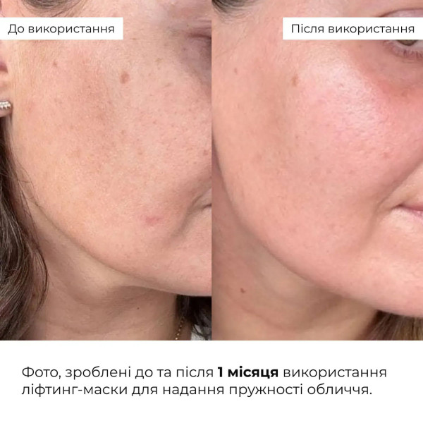Набір глиняних масок для догляду за шкірою обличчя Hillary Clay Mask Duo