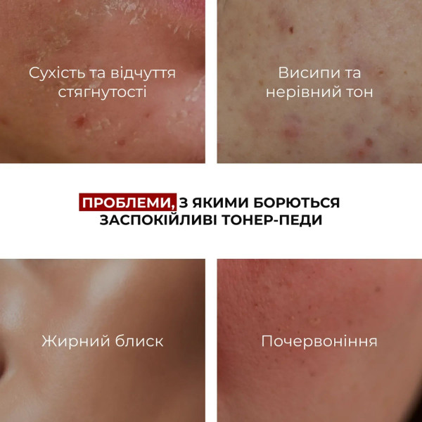 Набор с центеллой: гель, тонер-пэды и сыворотка Hillary Centella Face Care Set