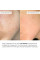 Набор для упругости и интенсивного увлажнения кожи лица Hillary Firming Intense Hydration Facial Set