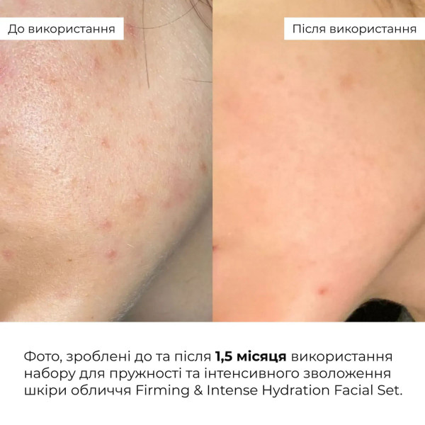Набор для упругости и интенсивного увлажнения кожи лица Hillary Firming Intense Hydration Facial Set