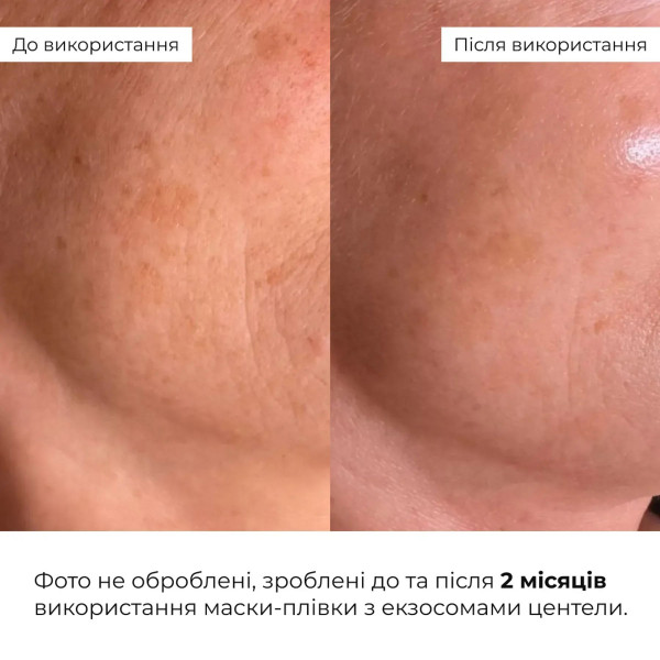 Набор для восстановления упругости кожи Hillary Skin Firmness Recovery Set
