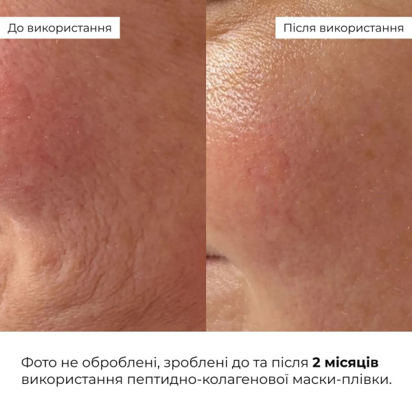Набор для восстановления упругости кожи Hillary Skin Firmness Recovery Set