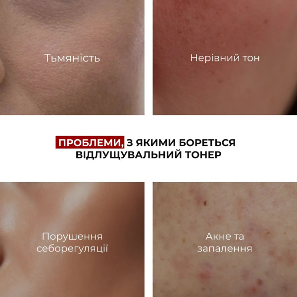 Набор с тонером, сывороткой и кремом для лица Hillary Face Care Trio