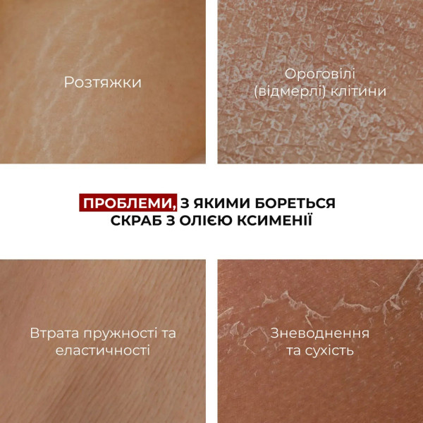 Набор против растяжек и для улучшения упругости кожи