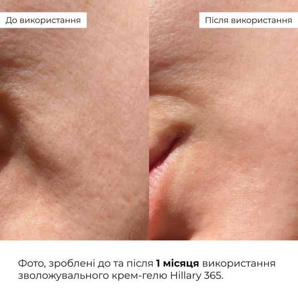Набор для интенсивного увлажнения Hillary Intensive Hydration Kit