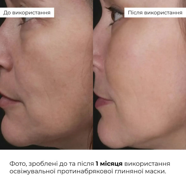 Набор глиняных масок Hillary Clay Mask Set