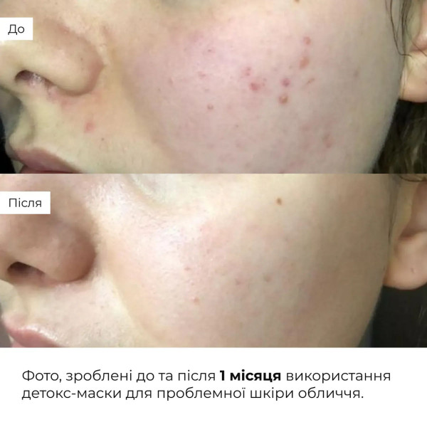 Набор глиняных масок Hillary Clay Mask Set